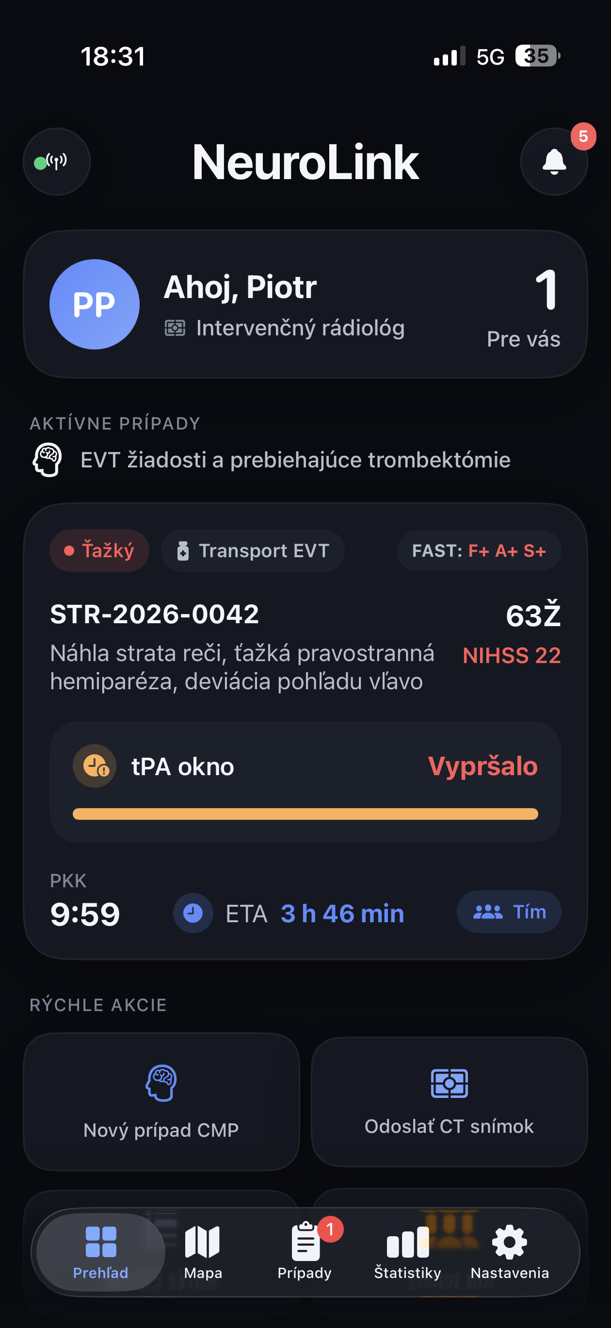 Lock Screen Live Activity